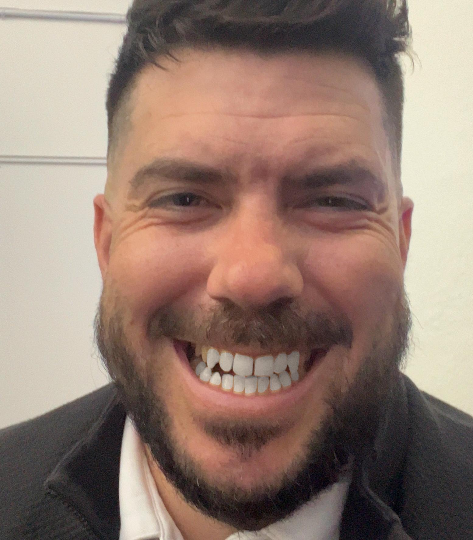 After dental treatment